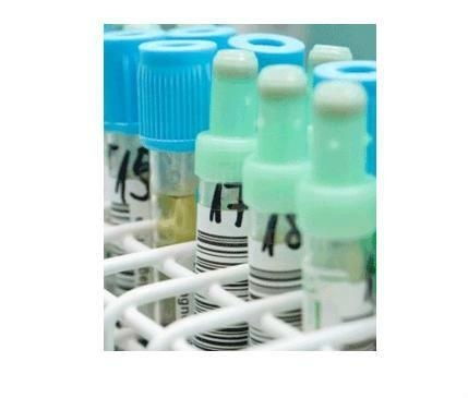 液體藥劑 非即飲型茶的創(chuàng)新應用與市場前景